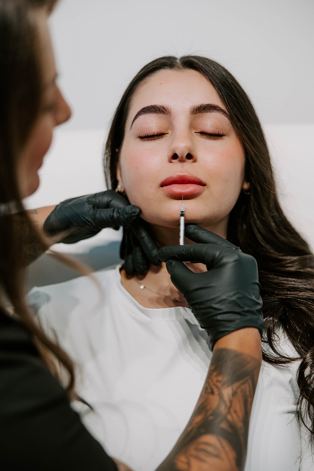 Cosmetic procedure: lip enhancement being administered.