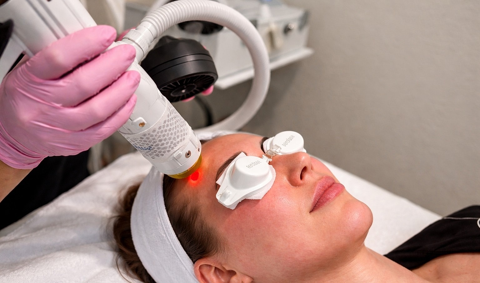 What Laser Treatment Is Best for Melasma? A Comparison Guide