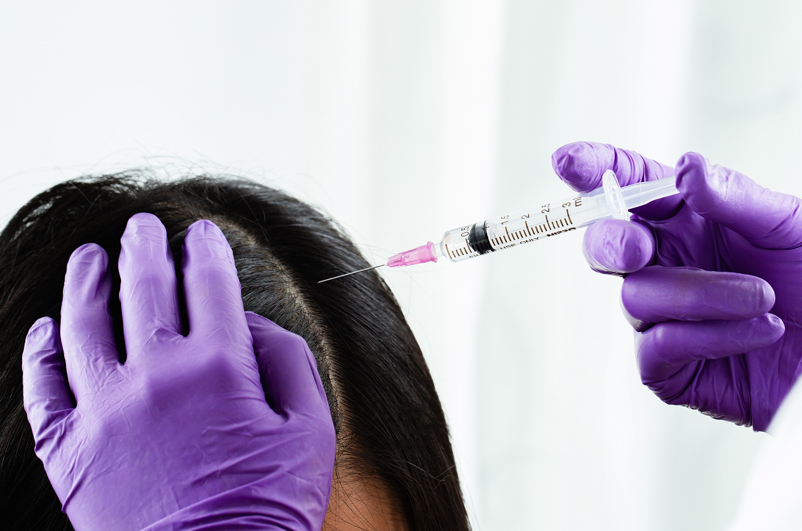 Keravive Hair Restoration in Boulder