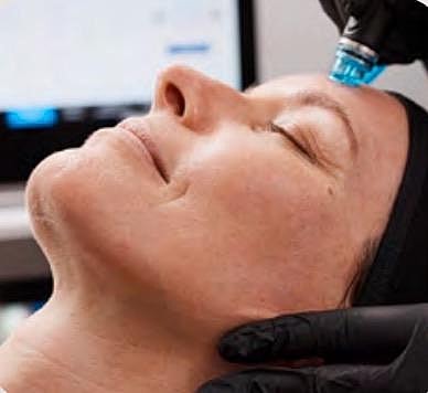 How Often Should You Get a Hydrafacial for Best Results?